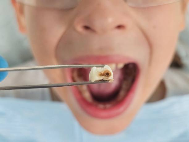 Best Broken Tooth Emergency  in Oakland, SC